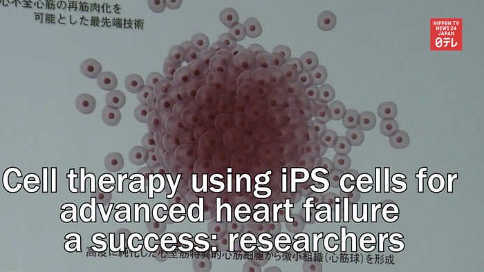 Experimental cell therapy using iPS cells for advanced heart failure a success: Japanese researchers