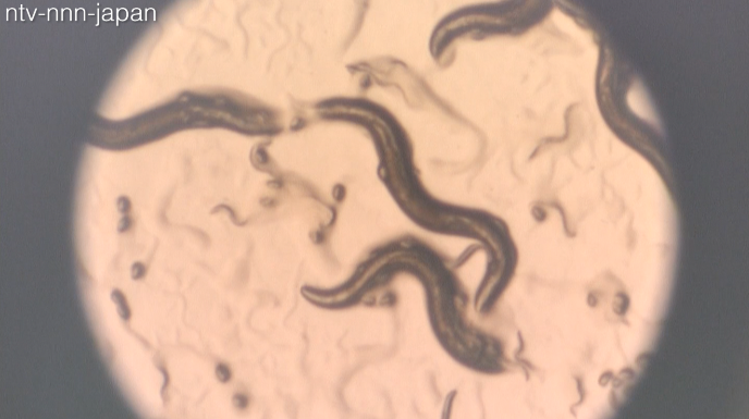 Roundworm test detects cancer with 95% accuracy