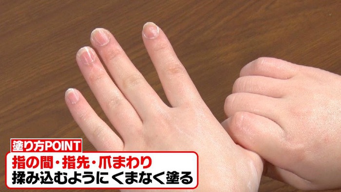 毎日のハンドケアに意外な落とし穴 皮膚科医に聞く 正しい手荒れ対策とは バゲット 日本テレビ