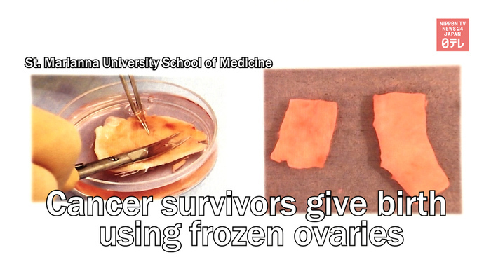 Cancer survivors give birth using frozen ovaries