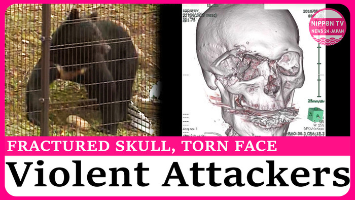 Bear attacks fracture skulls, tear off faces