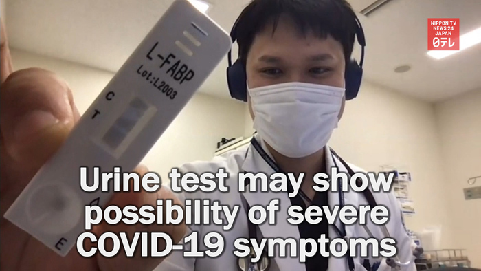 Urine test may show possibility of severe COVID-19 symptoms