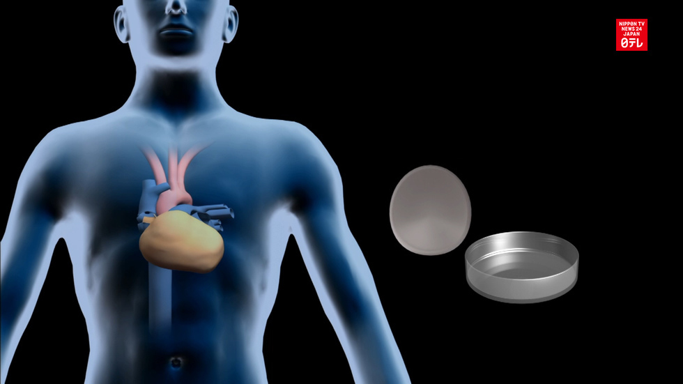 Scientists use stem cells to treat heart disease