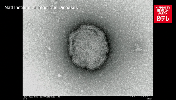 Over 300 mumps patients suffer hearing loss 