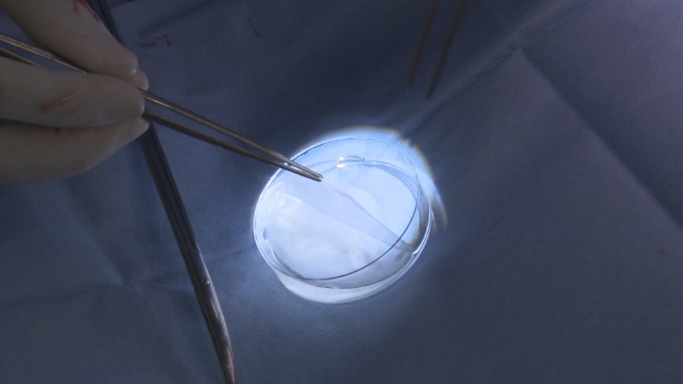 iPS heart therapy could enter human trials