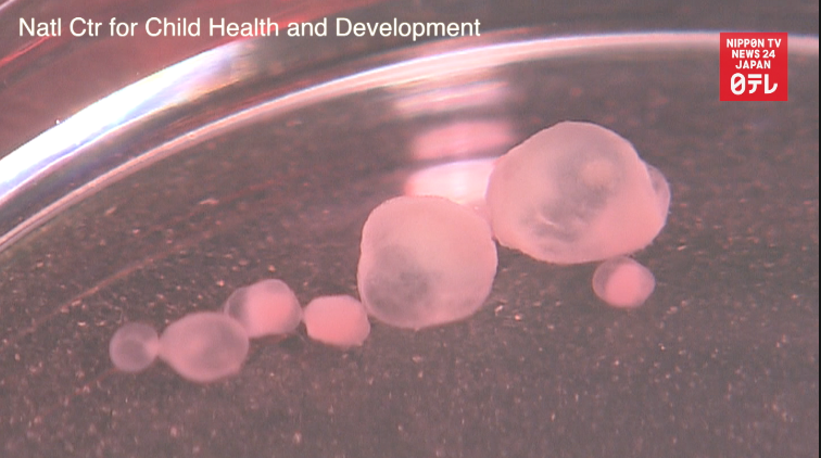 Scientists create intestinal tissue from stem cells 