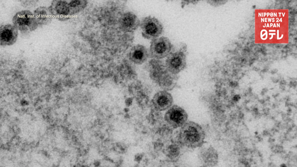 80% of rubella cases male 