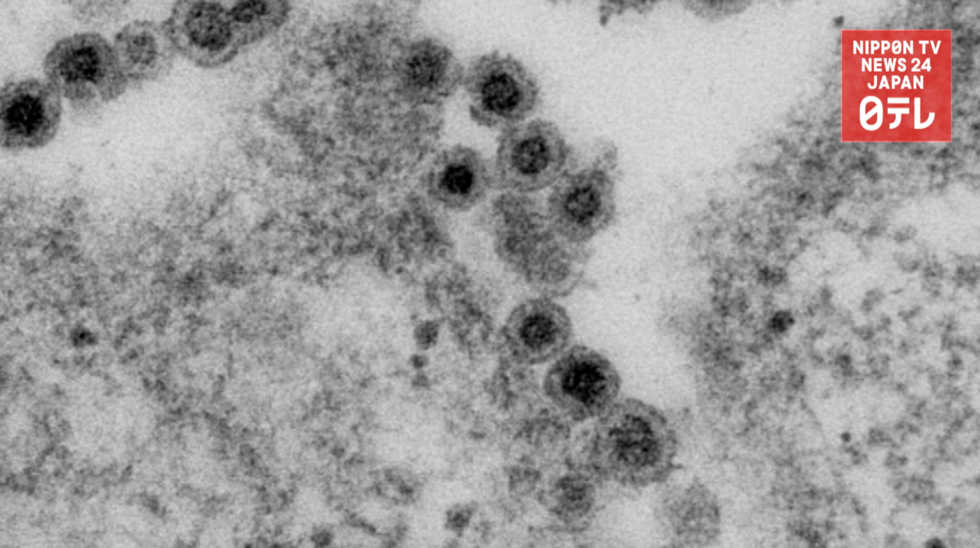 Rubella cases on the rise  