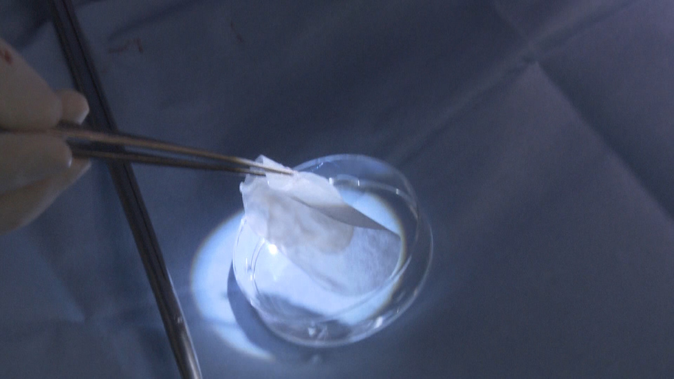 Government approves iPS cell heart treatment for human trials