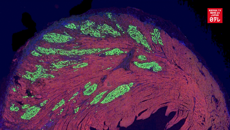 Stem cells heal damaged monkey heart