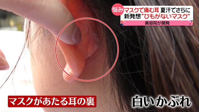 腫れ コロナ 耳 の 後ろ リンパ腺の腫れが耳の下に？疑われる病気とは