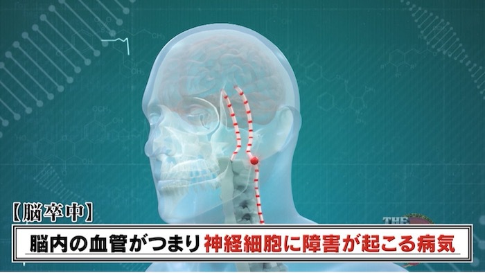 健康体の人が突如脳卒中に 生活における意外な原因とは The突破ファイル 日本テレビ